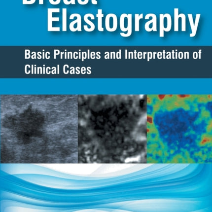 Breast Elastography: Basic Principles and