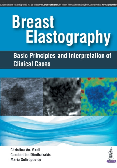 Breast Elastography: Basic Principles and