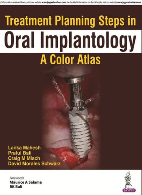 Treatment Planning Steps in Oral Implantology: A Color Atlas