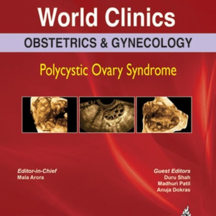 World Clinics: Obstetrics & Gynecology: Polycystic Ovary Syndrome: Volume 6, Number 1