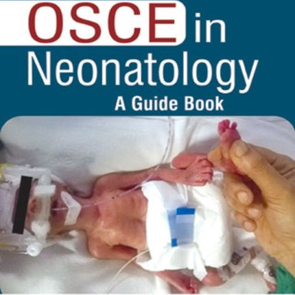 OSCE in Neonatology: A Guide Book