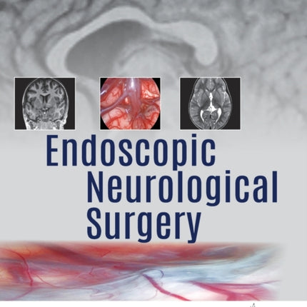 Endoscopic Neurological Surgery