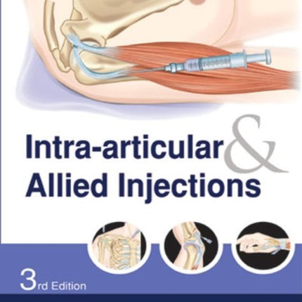 Intra-articular & Allied Injections