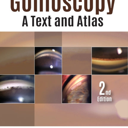Gonioscopy: A Text and Atlas