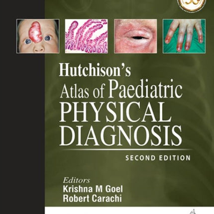 Hutchison's Atlas of Paediatric Physical Diagnosis