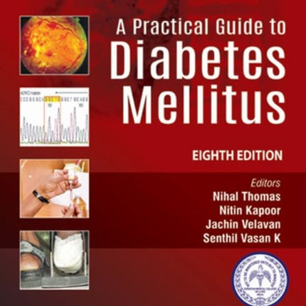 A Practical Guide to Diabetes Mellitus