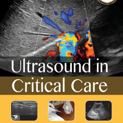 Ultrasound in Critical Care