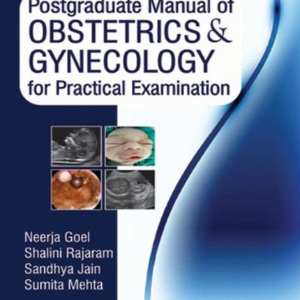 Postgraduate Manual of Obstetrics & Gynecology for Practical Examination