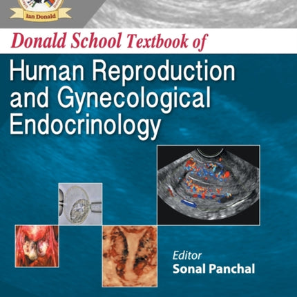 Donald School Textbook of Human Reproductive & Gynecological Endocrinology