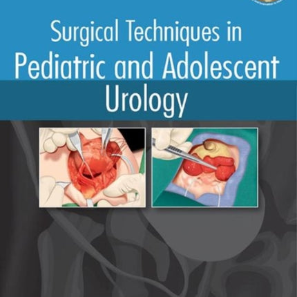 Surgical Techniques in Pediatric and Adolescent