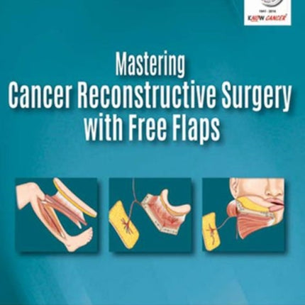 Mastering Cancer Reconstructive Surgery with Free Flaps