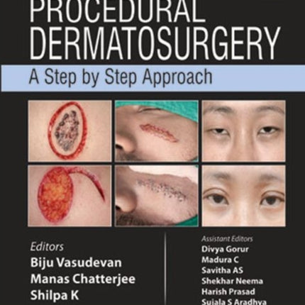 Procedural Dermatosurgery: A Step by Step