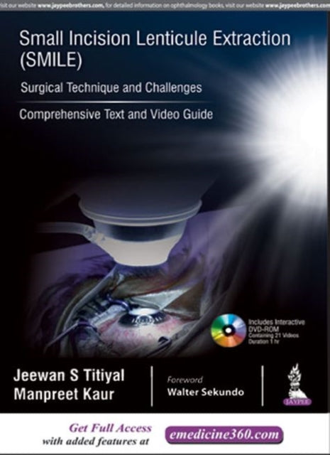 Small Incision Lenticule Extraction (SMILE): Surgical Technique and Challenges: Comprehensive Text and Video Guide