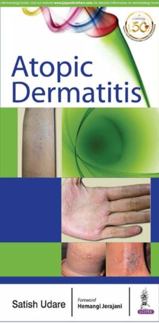 Atopic Dermatitis