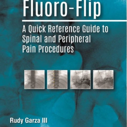 Fluoro-Flip: A Quick Reference Guide to Spinal