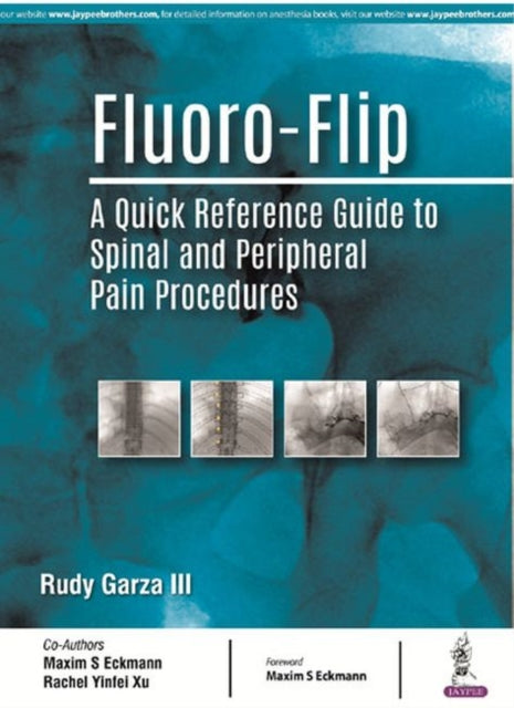 Fluoro-Flip: A Quick Reference Guide to Spinal