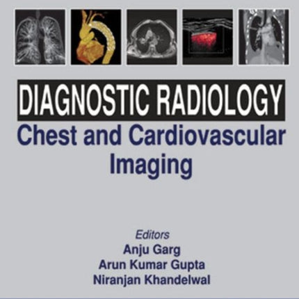 Diagnostic Radiology: Chest and Cardiovascular Imaging