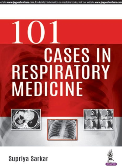 101 Cases in Respiratory Medicine