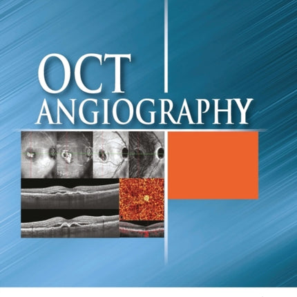 OCT Angiography