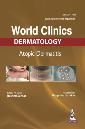 World Clinics: Dermatology: Atopic Dermatitis