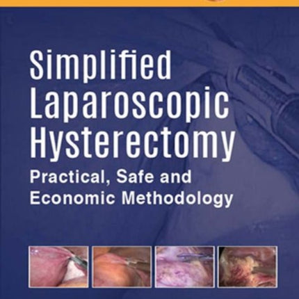 Simplified Laparoscopic Hysterectomy: Practical, Safe and Economic Methodology