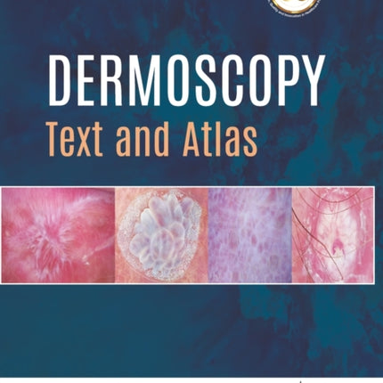 Dermoscopy: Text and Atlas