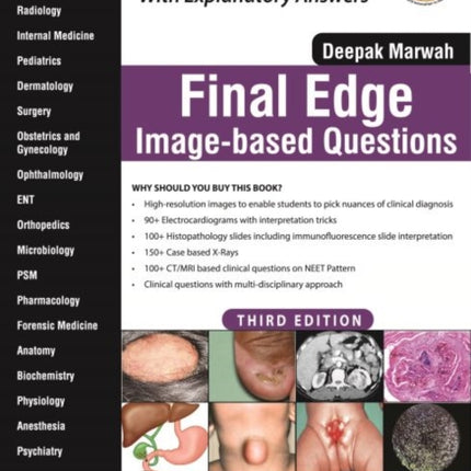 Final Edge: Image-based Questions