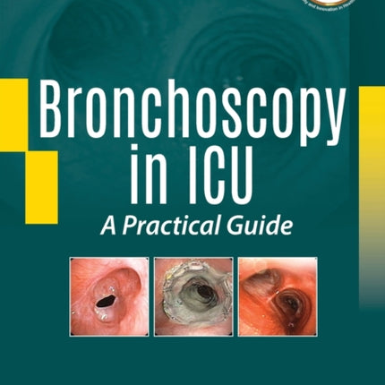 Bronchoscopy in ICU: A Practical Guide