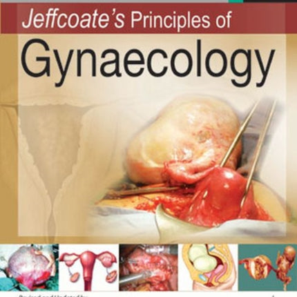 Jeffcoate's Principles of Gynaecology