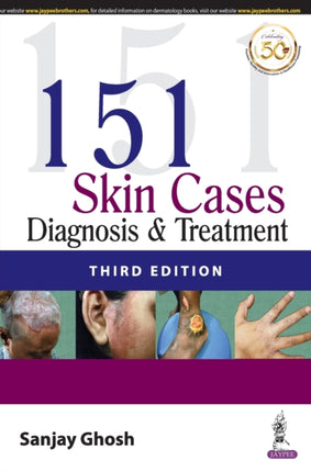 151 Skin Cases: Diagnosis & Treatment