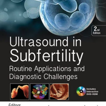 Ultrasound in Subfertility: Routine Applications and Diagnostic Challenges