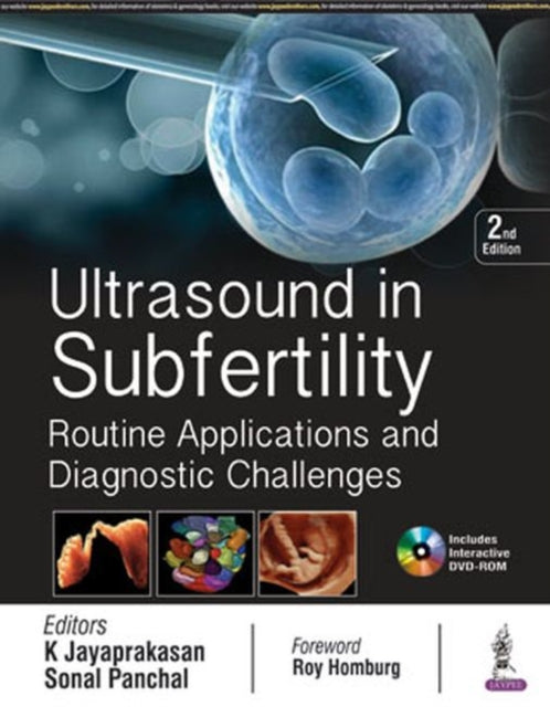 Ultrasound in Subfertility: Routine Applications and Diagnostic Challenges