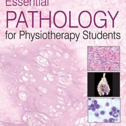 Essential Pathology for Physiotherapy Students