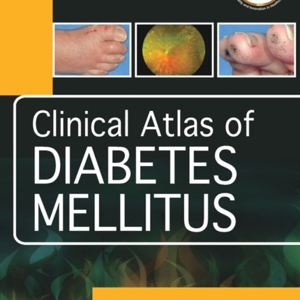 Clinical Atlas of Diabetes Mellitus