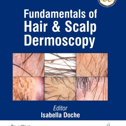 Fundamentals of Hair and Scalp Dermoscopy