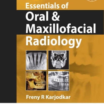 Essentials of Oral & Maxillofacial Radiology