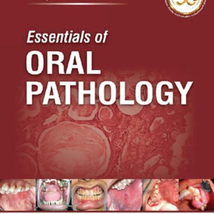 Essentials of Oral Pathology