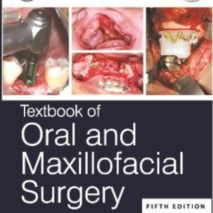 Textbook of Oral and Maxillofacial Surgery