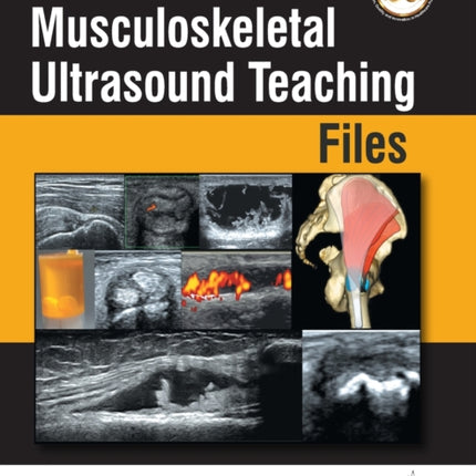 Musculoskeletal Ultrasound Teaching Files