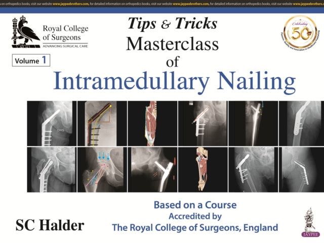 Tips and Tricks: Masterclass of Intramedullary