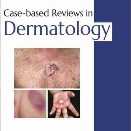 Case-based Reviews in Dermatology