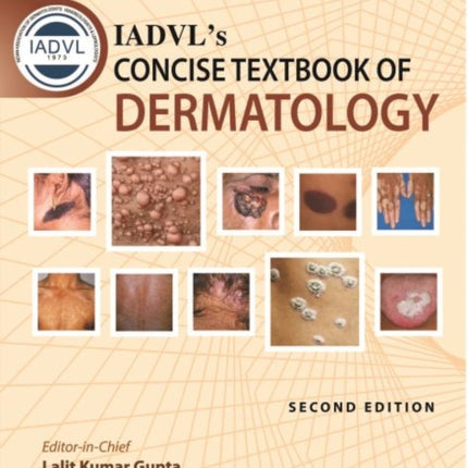 IADVL's Concise Textbook of Dermatology