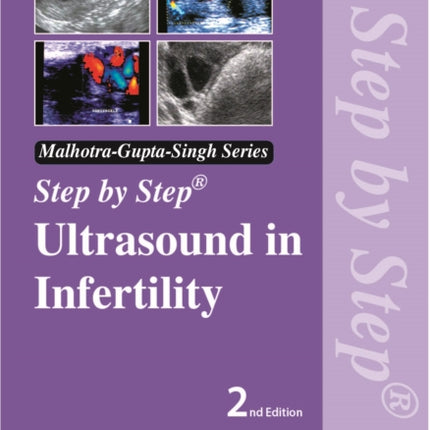 Step by Step Ultrasound in Infertility