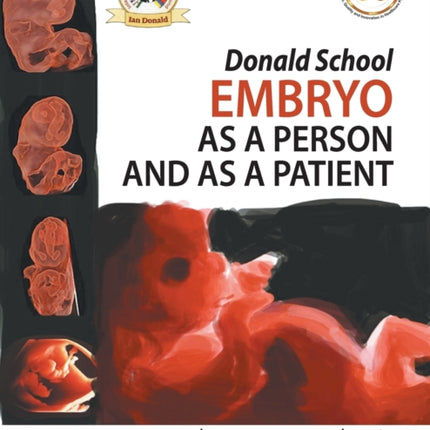 Donald School Embryo as a Person and as a Patient