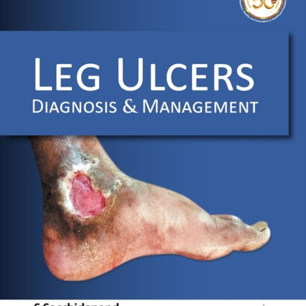 Leg Ulcers: Diagnosis & Management