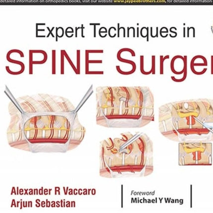 Expert Techniques in Spine Surgery