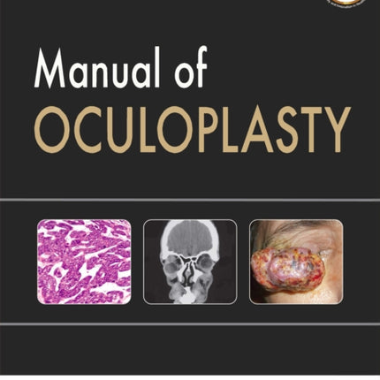 Manual of Oculoplasty
