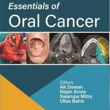 Essentials of Oral Cancer