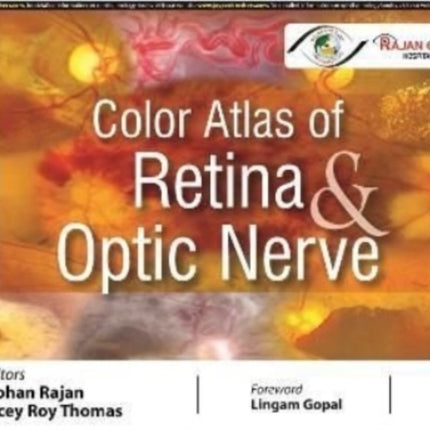 Color Atlas of Retina & Optic Nerve
