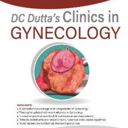 DC Dutta's Clinics in Gynecology